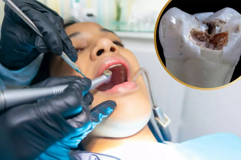 Texas Dental Warning – Cavities Are Contagious and Most People Don’t Know It