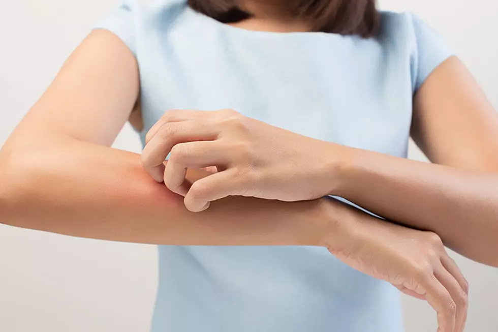 5 Surprising Reasons Mosquitoes May Bite You a Lot