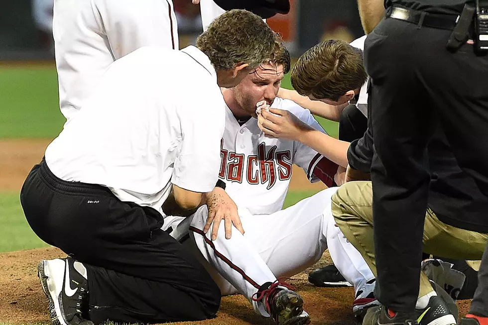 Diamondbacks Pitcher Archie Bradley Gets Face Bashed by a Line Drive